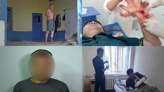 Фуқаро профилактика инспекторига болта билан ҳужум қилди