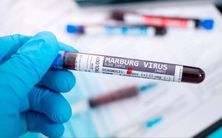 Узбекистан усиливает санитарный контроль на границах из-за риска Марбургской лихорадки