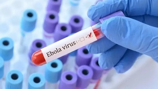 Во Франции выявили первый случай заболевания Эболой