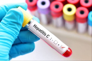 Узбекистанцы смогут сдать бесплатный тест на вирусные гепатиты