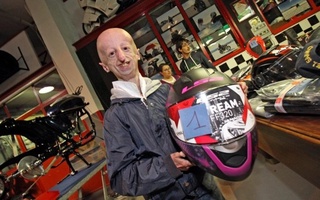 Проживший дольше всех с прогерией человек умер в возрасте 28 лет