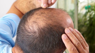 Soch nega toʻkiladi?