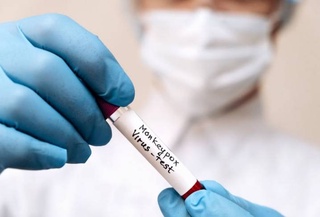 Новая смертельная пандемия грозит миру из-за мутированного штамма оспы обезьян