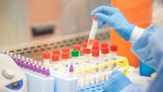 Yaponiyalik olimlar koronavirusning yangi shtammi qon tomirlariga qanday kirib borishini aniqladi