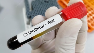 Nasliy angioedema: bemorlarga tibbiy yordam koʻrsatish uchun shifokorlar malakasi oshirilmoqda