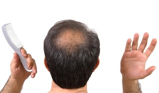 Soch ektirishda donor sochidan foydalanish mumkinmi?