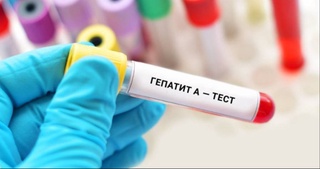 В школах Ташкента зафиксированы случаи гепатита A среди школьников