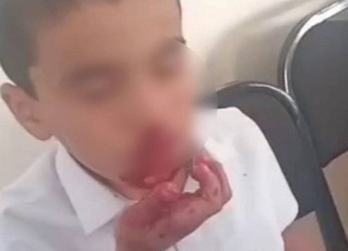 В Кашкадарье учительница английского языка разбила нос пятикласснику
