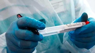 Tojikistonda koronavirus