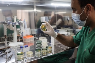 ЖССТ: Дунёда вабога чалиниш кўрсаткичи 58 фоизга ошди