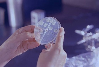 The hidden danger tuberculosis is spreading around the world without a major symptom