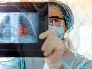 Gipertoniyaga qarshi dori vositasi saraton kasalligini davolashda samara berdi