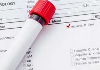 Вирусология илмий текшириш институти аҳолини бепул скрининг текширувидан ўтказмоқда