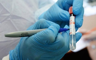 Coronavirus update: 2509 cases in Uzbekistan