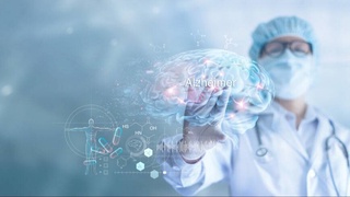 Аломати нави бемории Алтсгеймер ёфт шуд