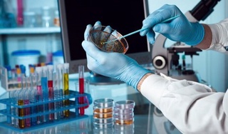 ЖССТ: Дунёда вабодан ўлим кўрсаткичлари ошмоқда