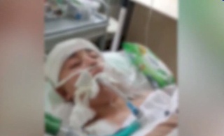 Toshkent viloyatida eri tomonidan kaltaklangan ayol vafot etdi