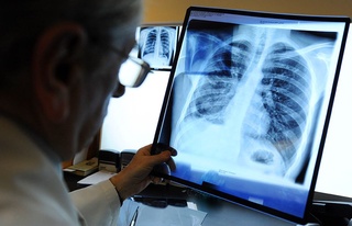 Фтизиатрия ва пульмонология хизмати қандай ривожлантирилади