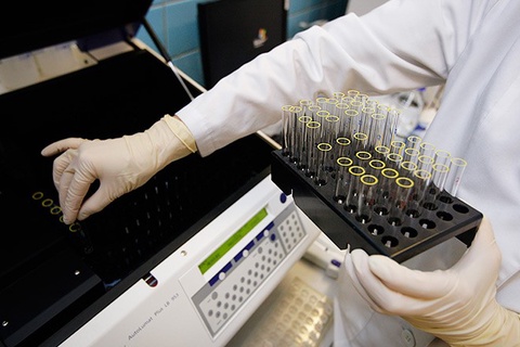 Yurtimizda 5 nafar sportchi doping qabul qilgani aniqlandi