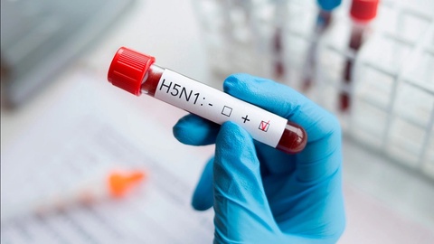 Парранда гриппи эпидемияга айланмайдими?