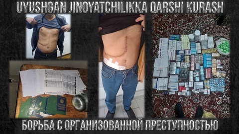 DXX hamda IIV xodimlari inson organlari savdosi bilan shugʻullangan jinoiy guruhni fosh etdi