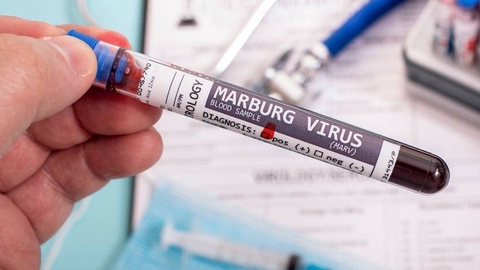 СУТ аз хатари эпидемияи ҷаҳонии вируси Марбург ҳушдор медиҳад