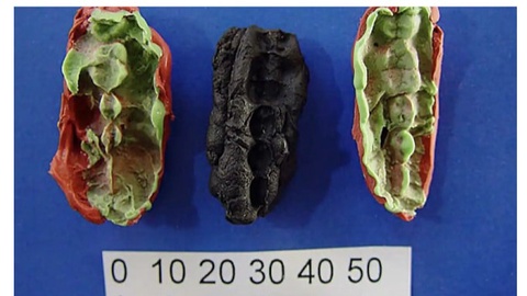 DNA From 10,000-Year-Old "Chewing Gum" Reveals Stone Age Secrets