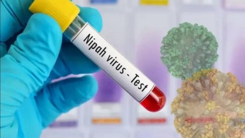 “Nipah” вирусига қарши илк вакцина синовлари Бельгияда бошланади