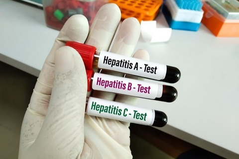 Gepatit har 30 soniyada bir kishining oʻlimiga sabab boʻlmoqda
