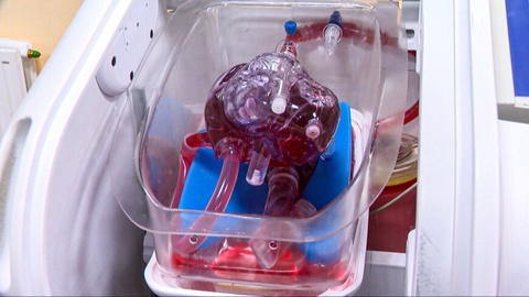 Қазақстандық дәрігерлер адам ағзасын трансплантациялауда тиімділігі жоғары құрылғы ойлап тапты