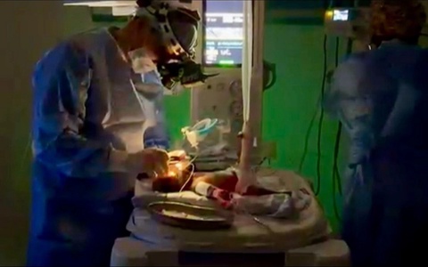 Чимкентда 650 грамм вазнга эга чақалоқнинг кўзини операция қилишди