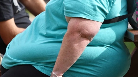 Ortiqcha semirish – faqat estetik muammogina emas