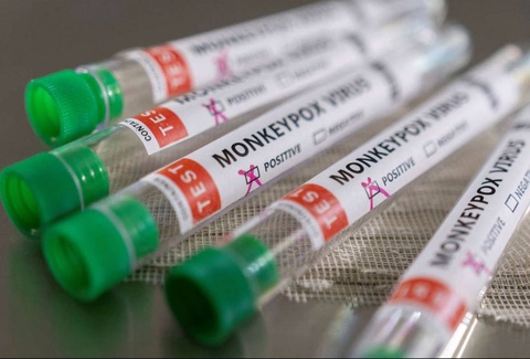India is working on developing a vaccine against monkey pox