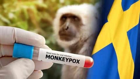 Африкадан ташқарида маймун чечагига чалиниш билан боғлиқ илк ҳолат аниқланди